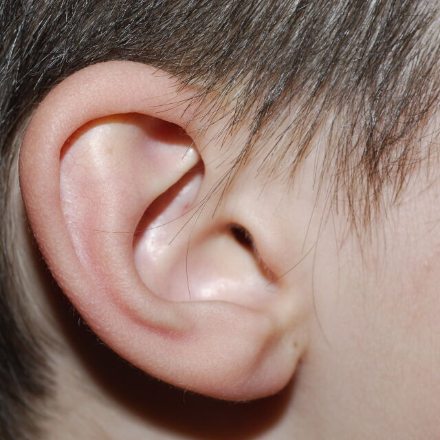 ВМА възстановява операциите на деца със слухови увреждания