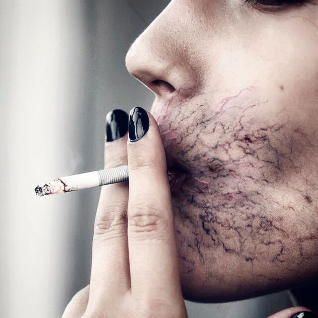 Тютюнопушенето ще убива с 30% повече хора към 2030 г.