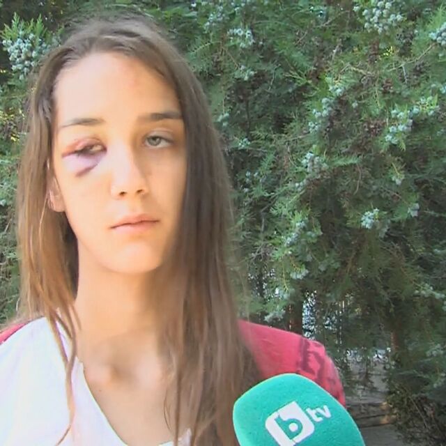 Необяснима агресия: Мъж от Несебър преби 13-годишно момиче посред бял ден