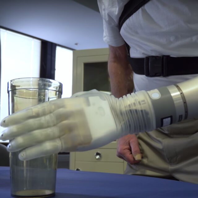 Нов тип роботизирана протеза връща усещането за допир с ръка