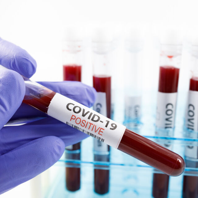 Отново ръст на заразените с COVID-19 у нас – 325 за ден