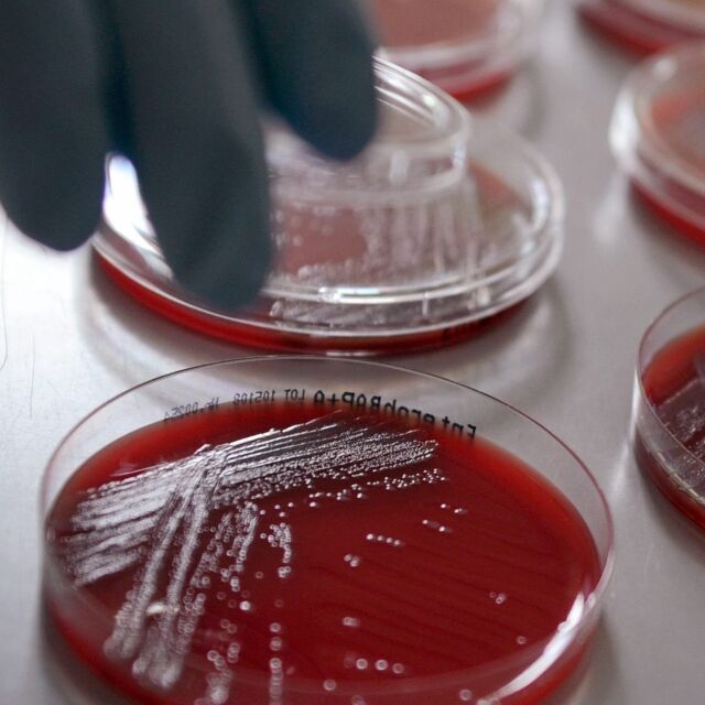 Супербактерии: „Оксфорд“ разкрива институт по антибиотици