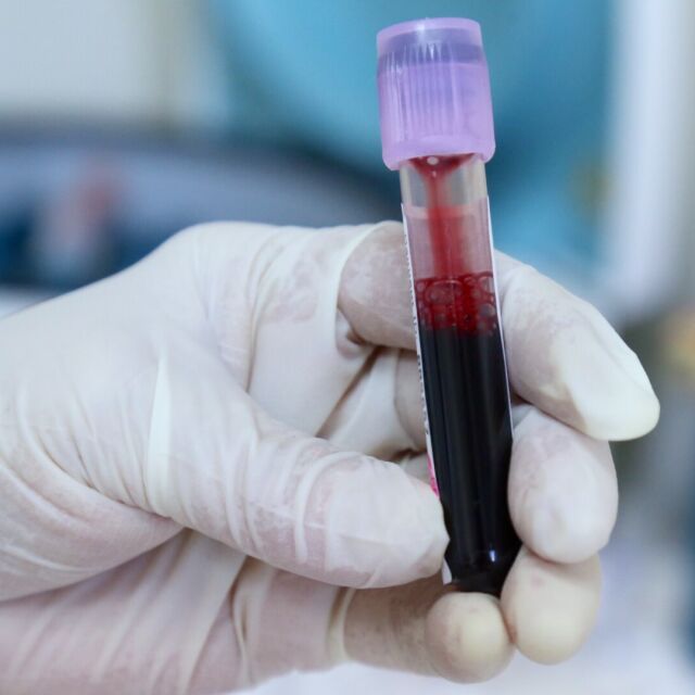 Експериментален кръвен тест засича рак 4 години преди появата на симптоми
