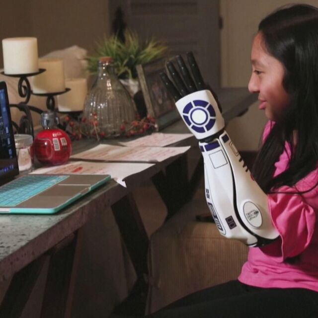 Mомиче се сдоби с ръка като на роботчето от "Междузвездни войни"
