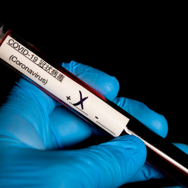210 нови случаи на коронавирус у нас за денонощие