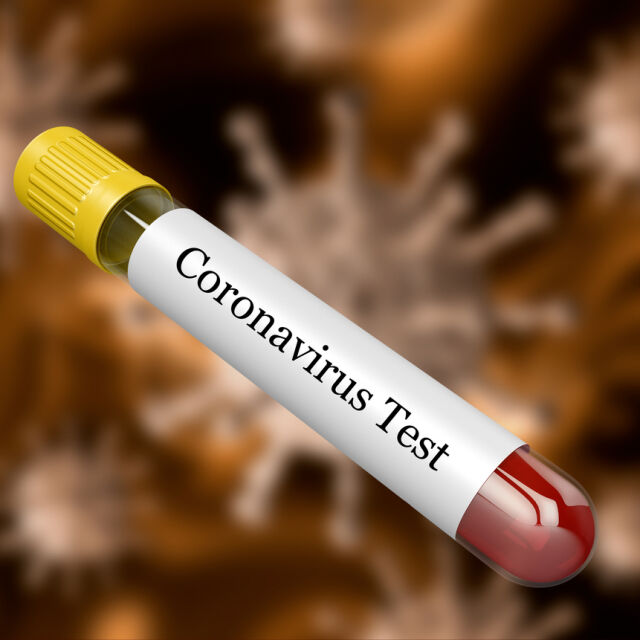 Осемте съмнителни проби за коронавирус са отрицателни