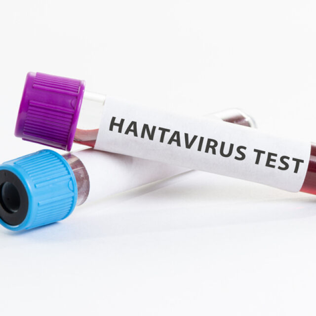 Хантавирус уби един в Китай – повод за паника ли е това