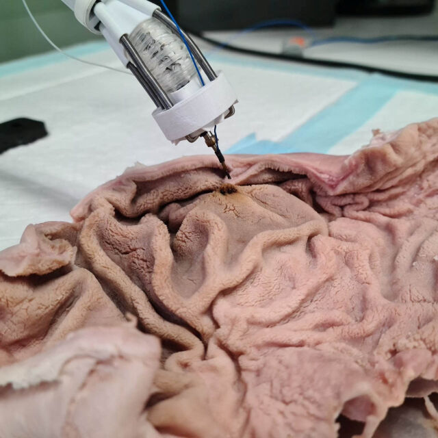 Австралийски биоинженери отпечатват 3D органи директно в човешкото тяло (ВИДЕО и СНИМКИ)