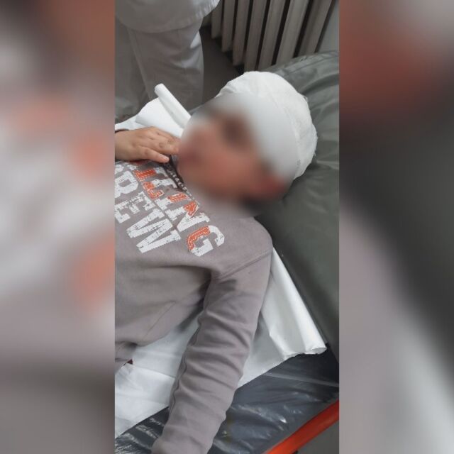 Куче нахапа 5-годишно дете в Ловеч