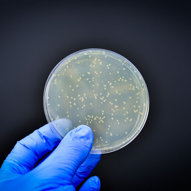 Изкуствен интелект откри нов антибиотик за супербактерии