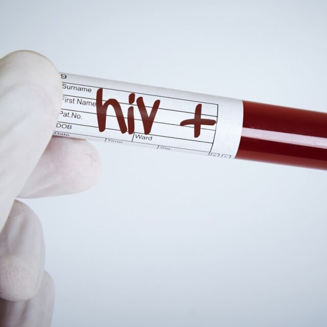 Учени приложиха терапия с вируса ХИВ при имунен дефицит