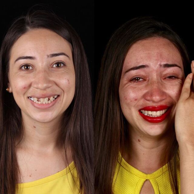 Този зъболекар връща безплатно усмивките на лицата на хората - снимки преди и след
