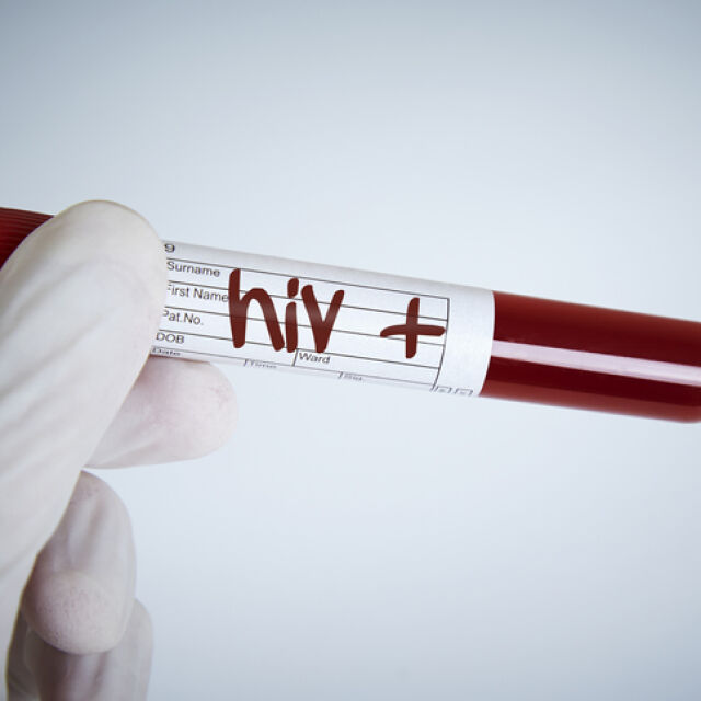 Пациент с ХИВ влезе в ремисия само след прием на медикаменти