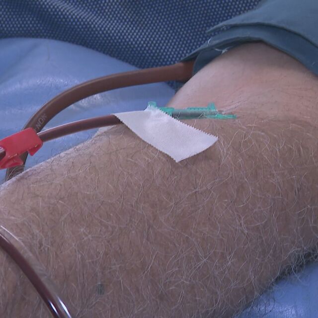 Как протича процедурата по даряване на кръвна плазма във ВМА
