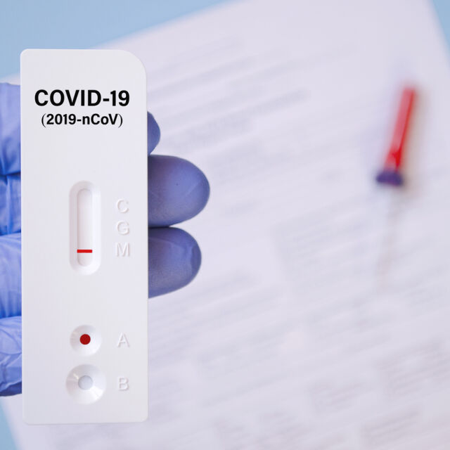 Антигенните тестове: Ще станат ли платени в COVID зоните?
