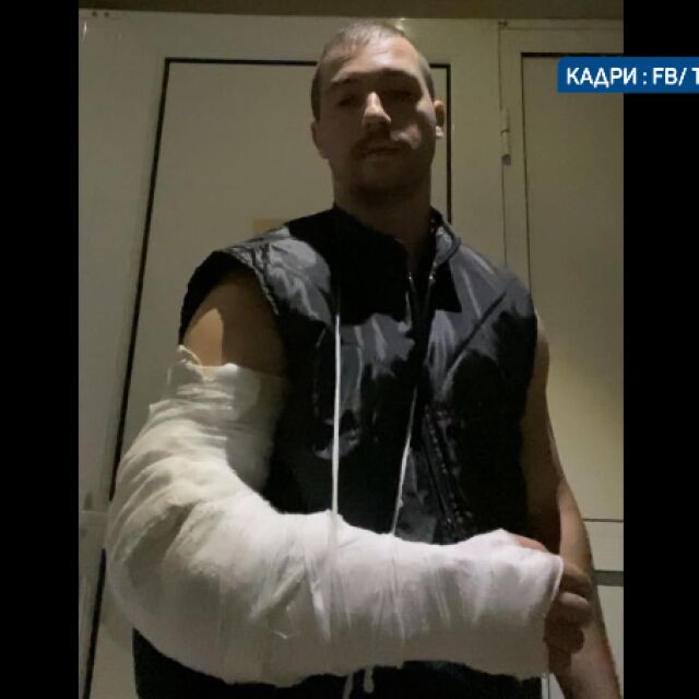  Сигнал за побой с бухалка на чиновник на казино в Бяла Слатина 