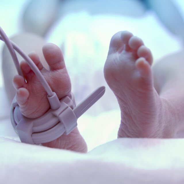 Бебето, чиито родители отказаха кръв от ваксинирани донори, е оперирано 
