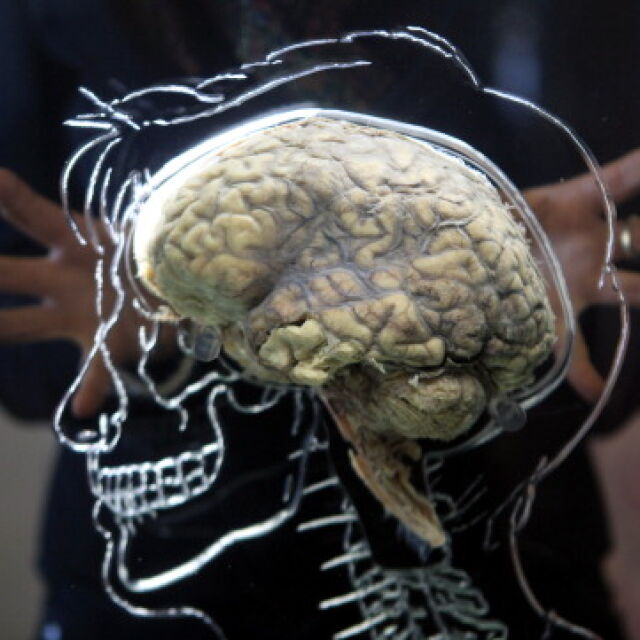 Мозъкът на човека непрекъснато се обновявa