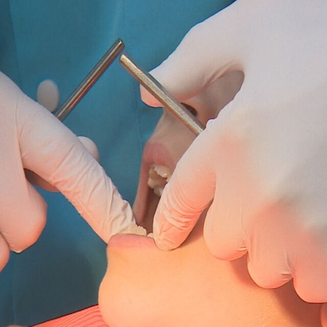 Зъболекари искат повече клинични пътеки за дентални дейности