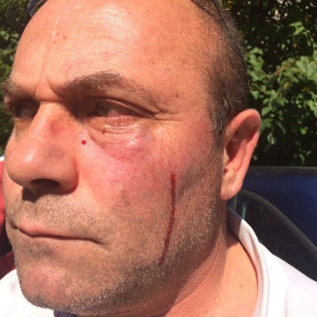 Нападнаха екип на Нова телевизия в ромска махала в Самоков