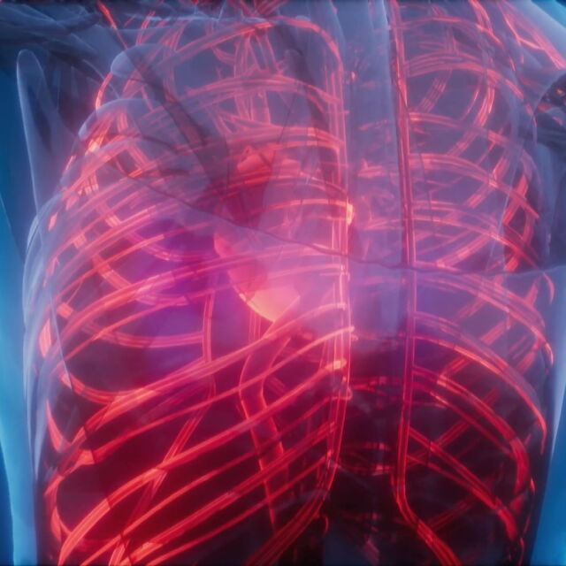Кардиолог: Внезапното излагане на студ при хора с високо кръвно води до спазъм на артериите на сърцето