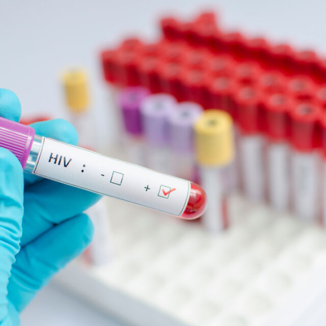 В САЩ съобщиха за първата жена, излекувана от ХИВ вируса