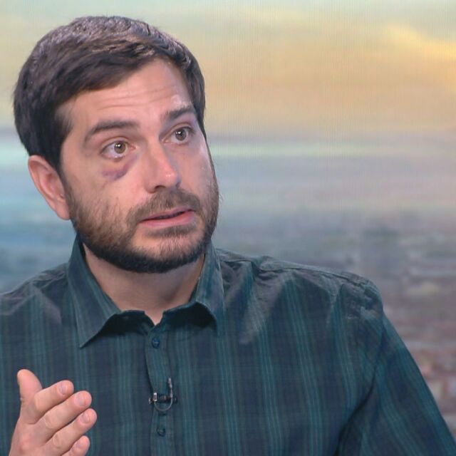 Битият Димитър Кенаров: Крещях, че съм журналист, става въпрос за полицейски произвол