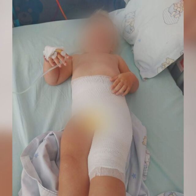2-годишно дете получи изгаряне в детска ясла в София