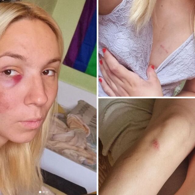 Емили пак е насинена – транс момичето отново пострада на пътя (СНИМКИ)