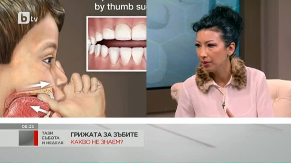 Д-р Ирена Хасара: Необходимо е зъбите да се мият след всяко хранене – кръгообразно, изчеткващо, от венеца към режещия ръб