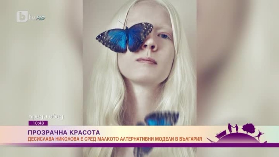 Какъв е животът на едно младо момиче албинос в България?