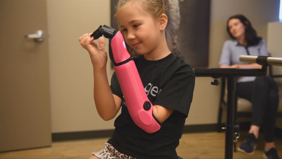 8-годишно момиче използва бионичната си ръка за първи път (ВИДЕО)