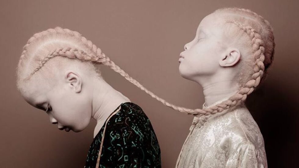 Лара и Мара – близначките-албиноси, взривили модния свят