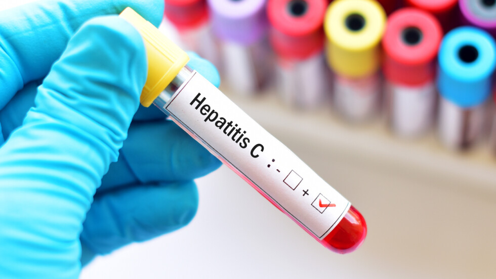 НЦЗПБ: Няма остър хепатит у нас 