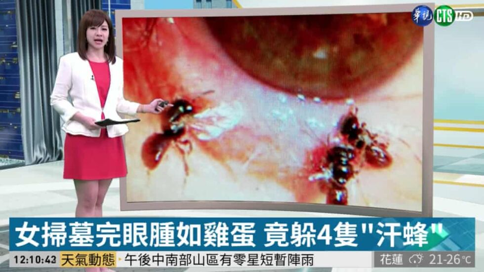 Лекари извадиха четири живи пчели от окото на жена в Тайван (СНИМКИ)