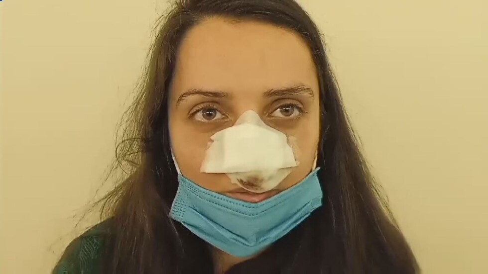 Зов за помощ: Момиче се нуждае от операция на лицето след ухапване от куче