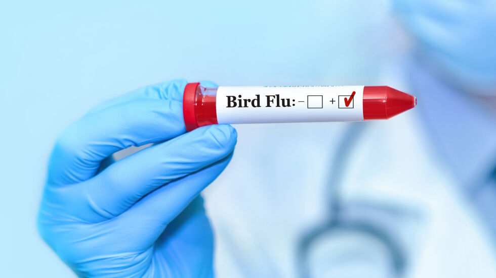  Нов случай на птичи грип при човек в Тексас 
