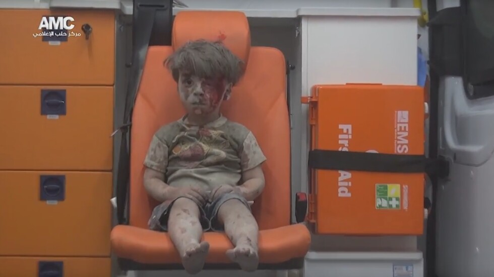 Спасителят на малкия Омран: Той не е единствената жертва на бомбите (ВИДЕО)
