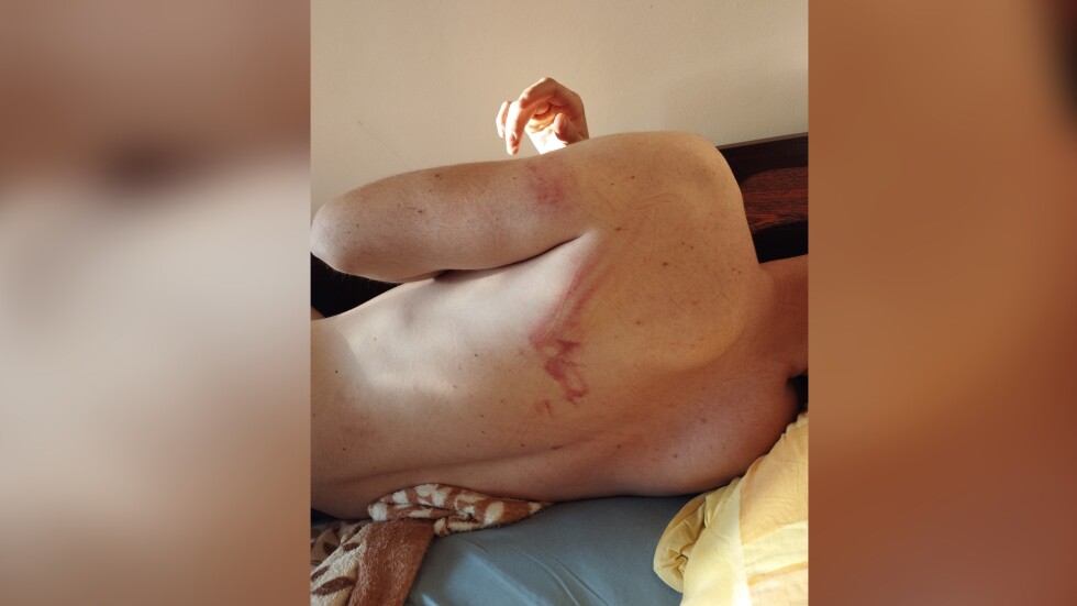 22-годишен мъж се оплака от полицейско насилие в Козлодуй