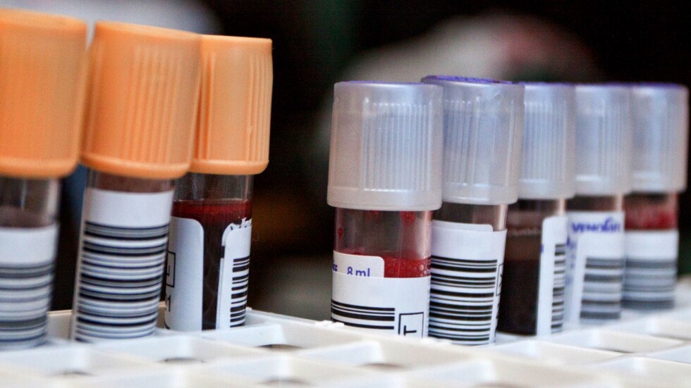 Проверка в Кръвния център откри недостиг на тестове за изследване на кръвта