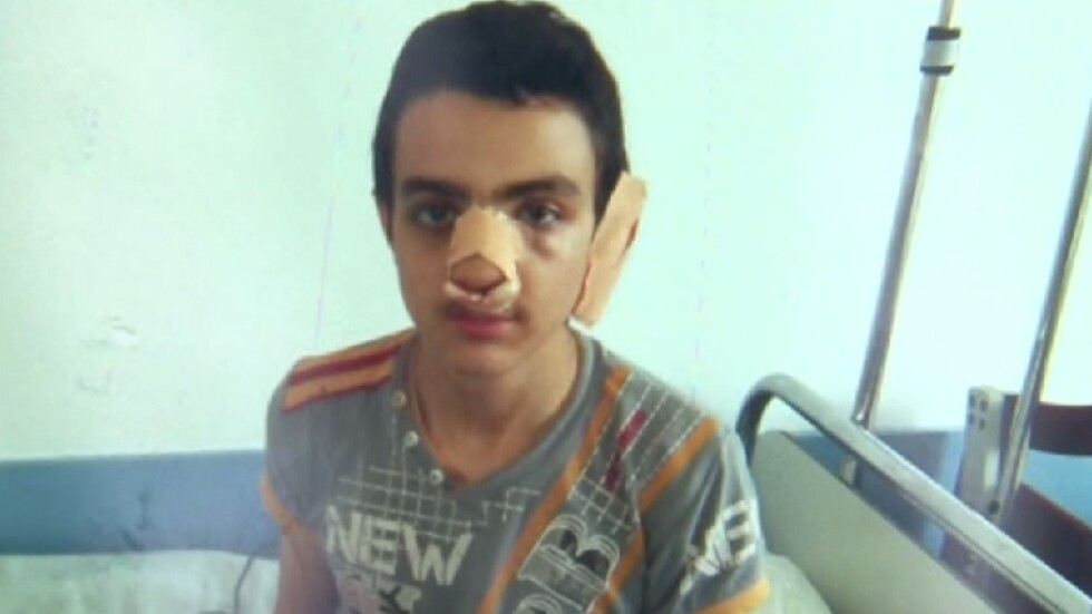 Младежи с качулки нападнаха сирийски ученик във Варна