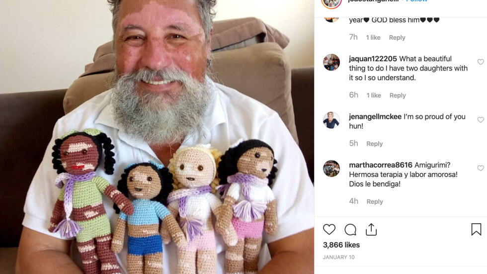 Бразилски дядо плете кукли за деца с витилиго, за да не се чувстват различни (СНИМКИ)