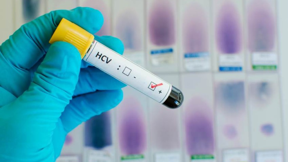 Кръвните центрове вече ще информират лично хората, у които открият хепатит