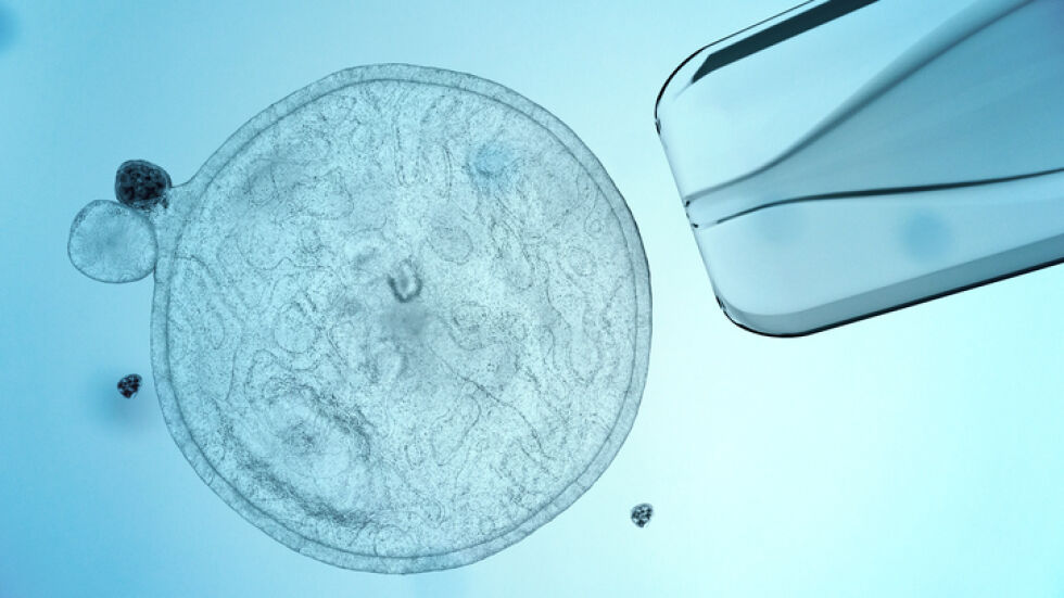 Отгледаха човешки яйцеклетки в лабораторни условия