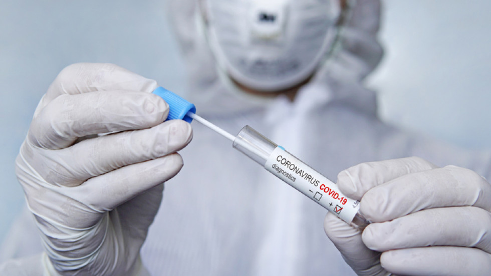 500 нови случая на коронавируса, около 16% са положителните тестове
