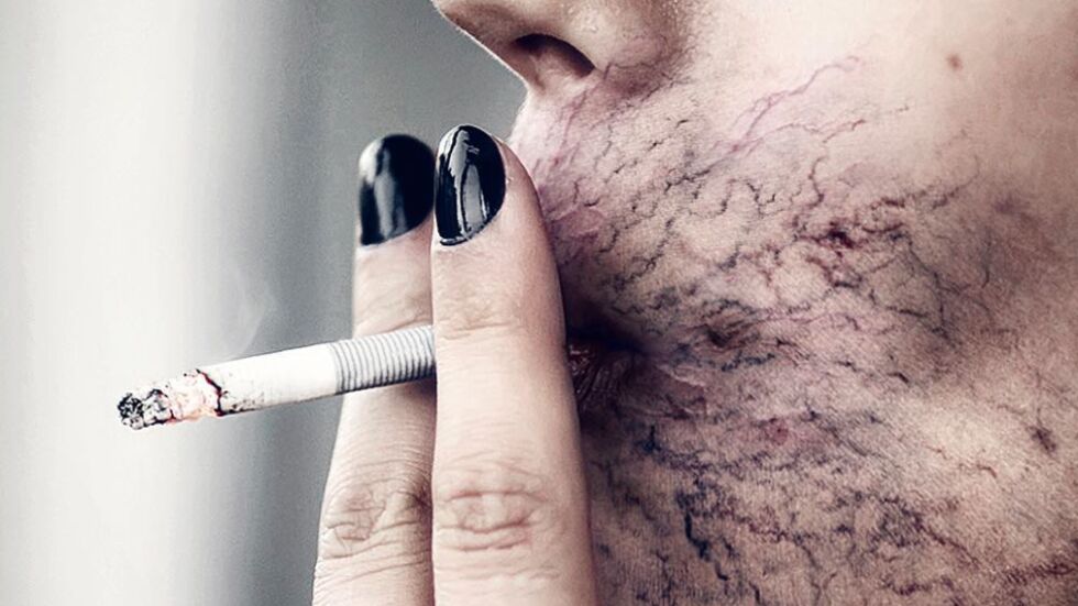 Тютюнопушенето ще убива с 30% повече хора към 2030 г.