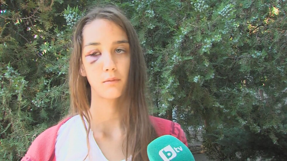 Необяснима агресия: Мъж от Несебър преби 13-годишно момиче посред бял ден