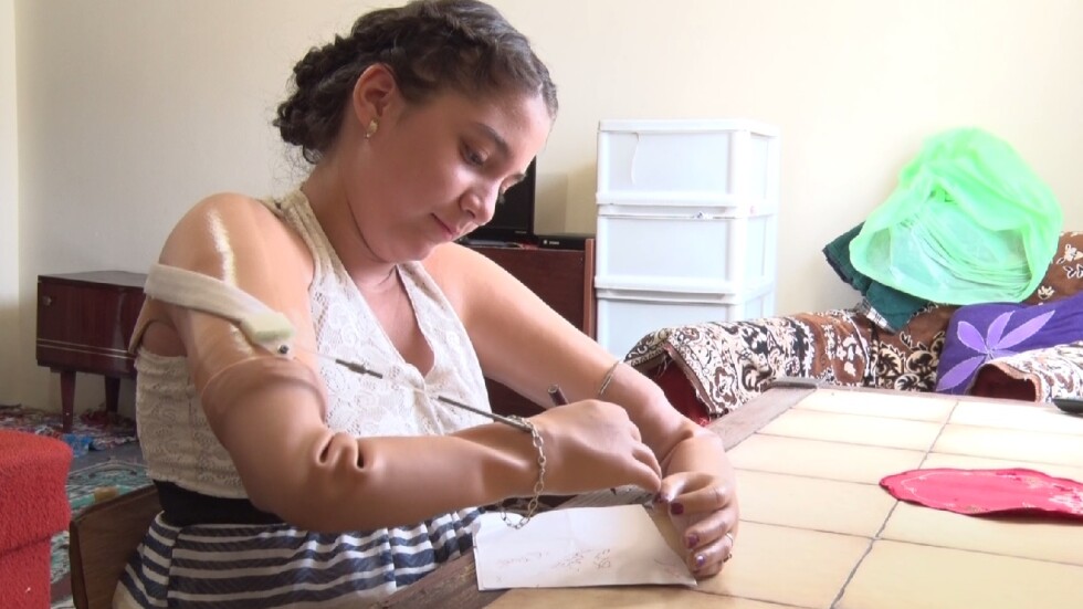 Български учен изработи протези за 10-годишно момиче без крайници