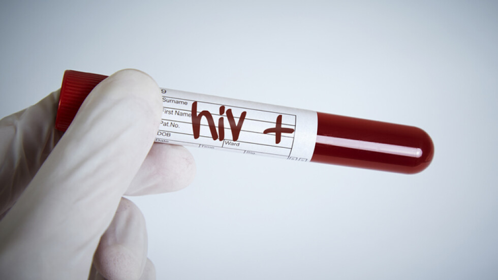 Пробив: Учени елиминираха ХИВ от ДНК-то на мишки