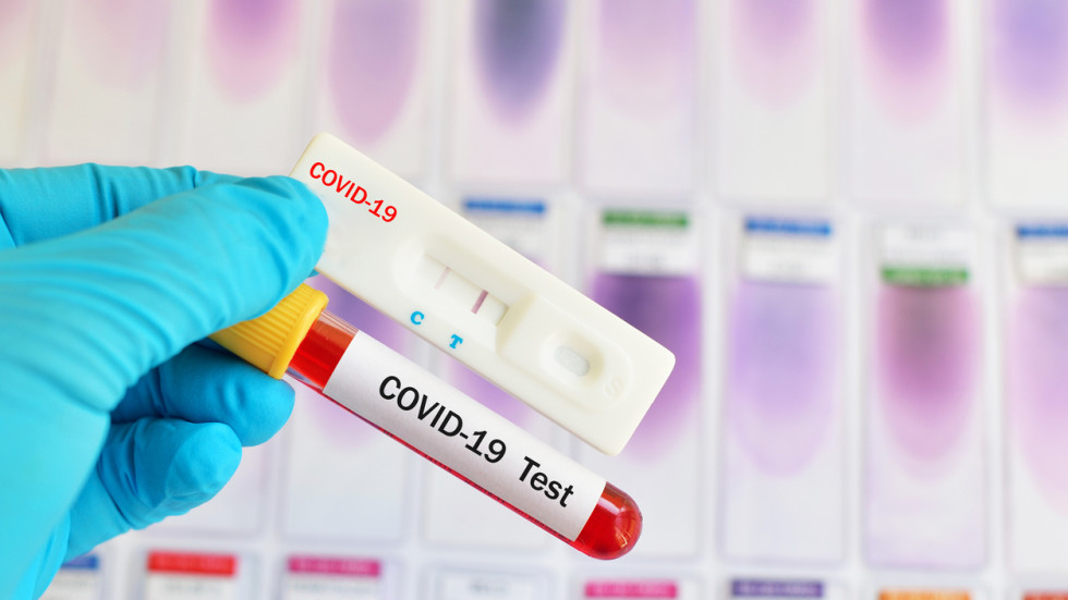 За денонощие: Повече излекувани, отколкото заразени с COVID-19